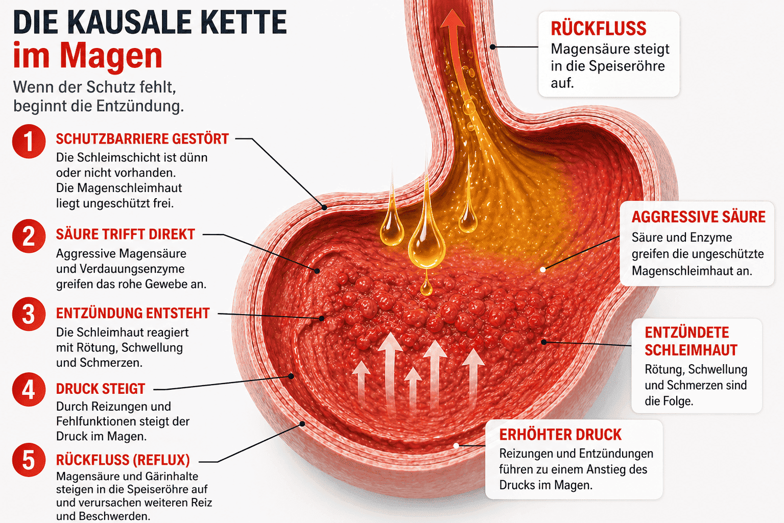 Infografik: Die kausale Kette im Magen – gestörte Schutzbarriere, aggressive Säure, Entzündung, Druckanstieg und Reflux beim Hund